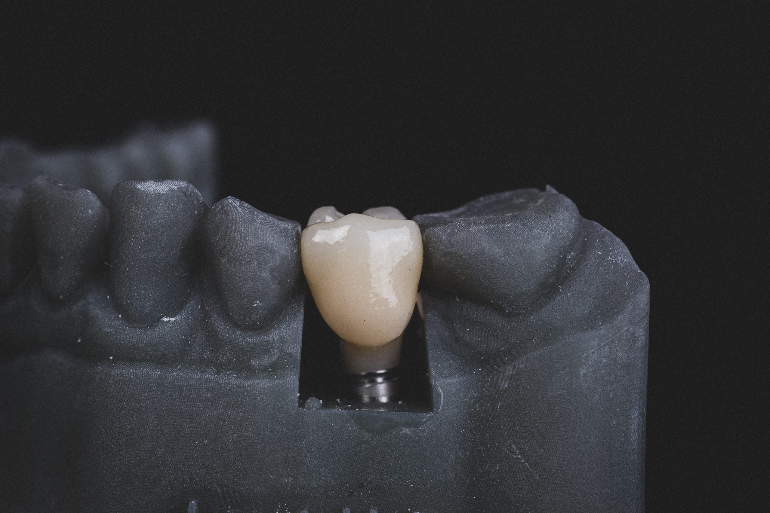 Implant Supported Dental Prostheses and its Maintenance Protocols