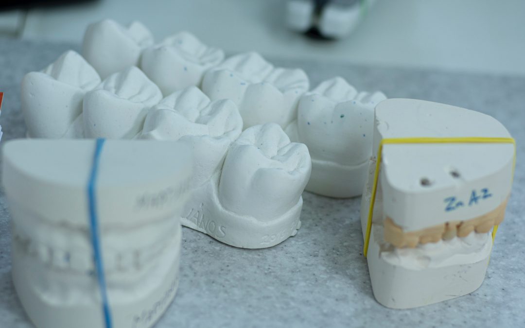 The case for pressed ceramic veneers