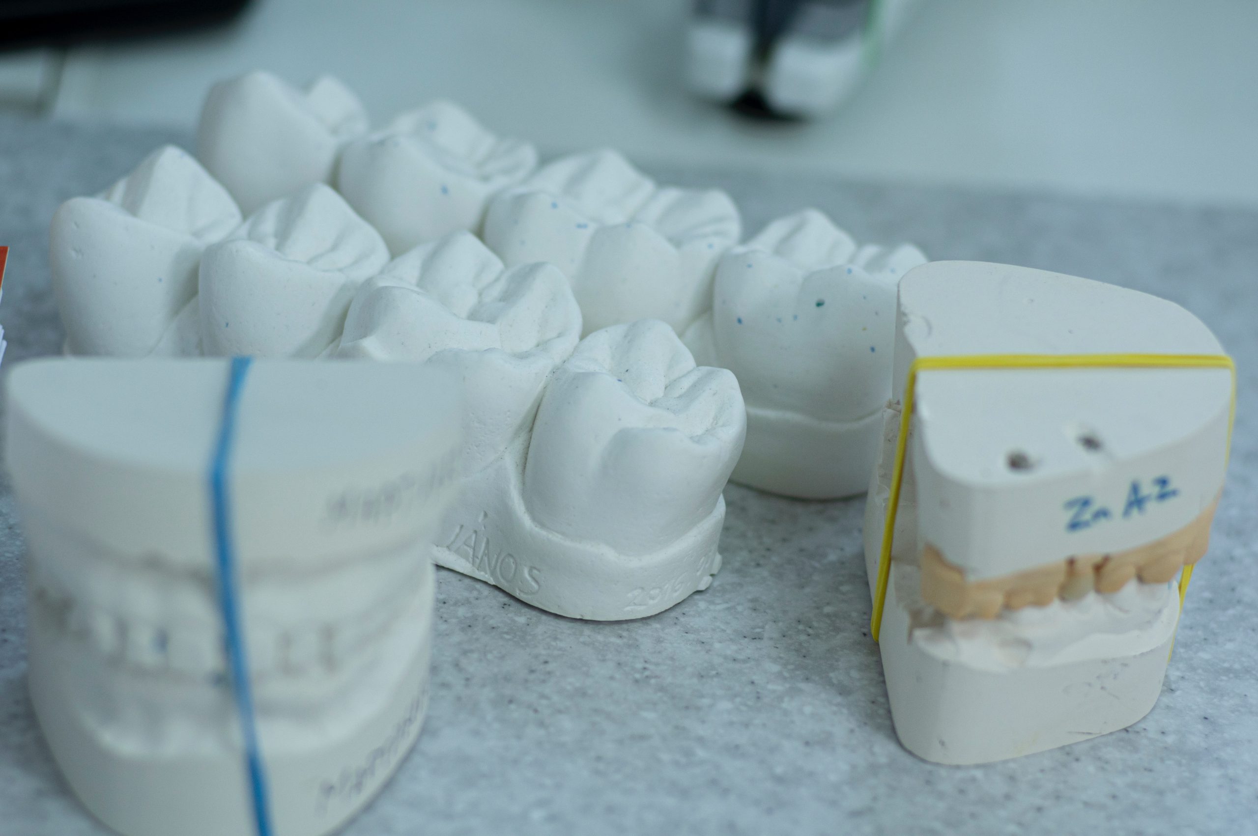 The case for pressed ceramic veneers