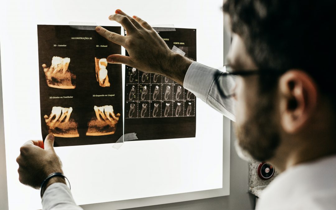 Managing Discolored Teeth After Dental Trauma