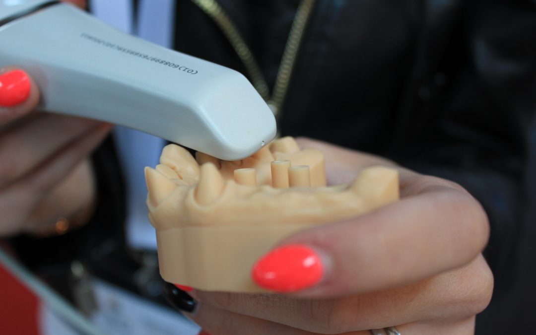 What is a Dental Cantilever Bridge? Pros and Cons Explained