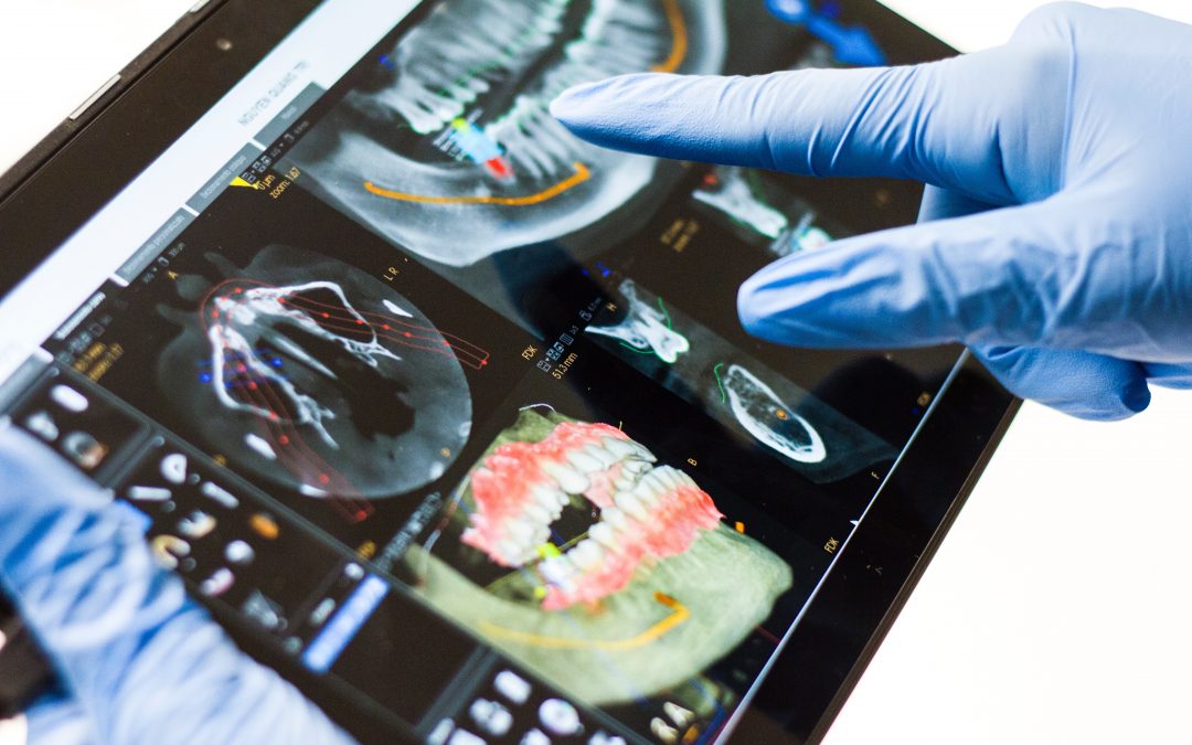 The Use of Digital Smile Design for Everyday Dentistry