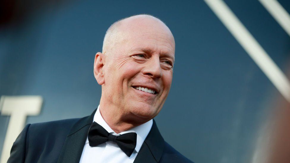 Bruce Willis has frontotemporal dementia