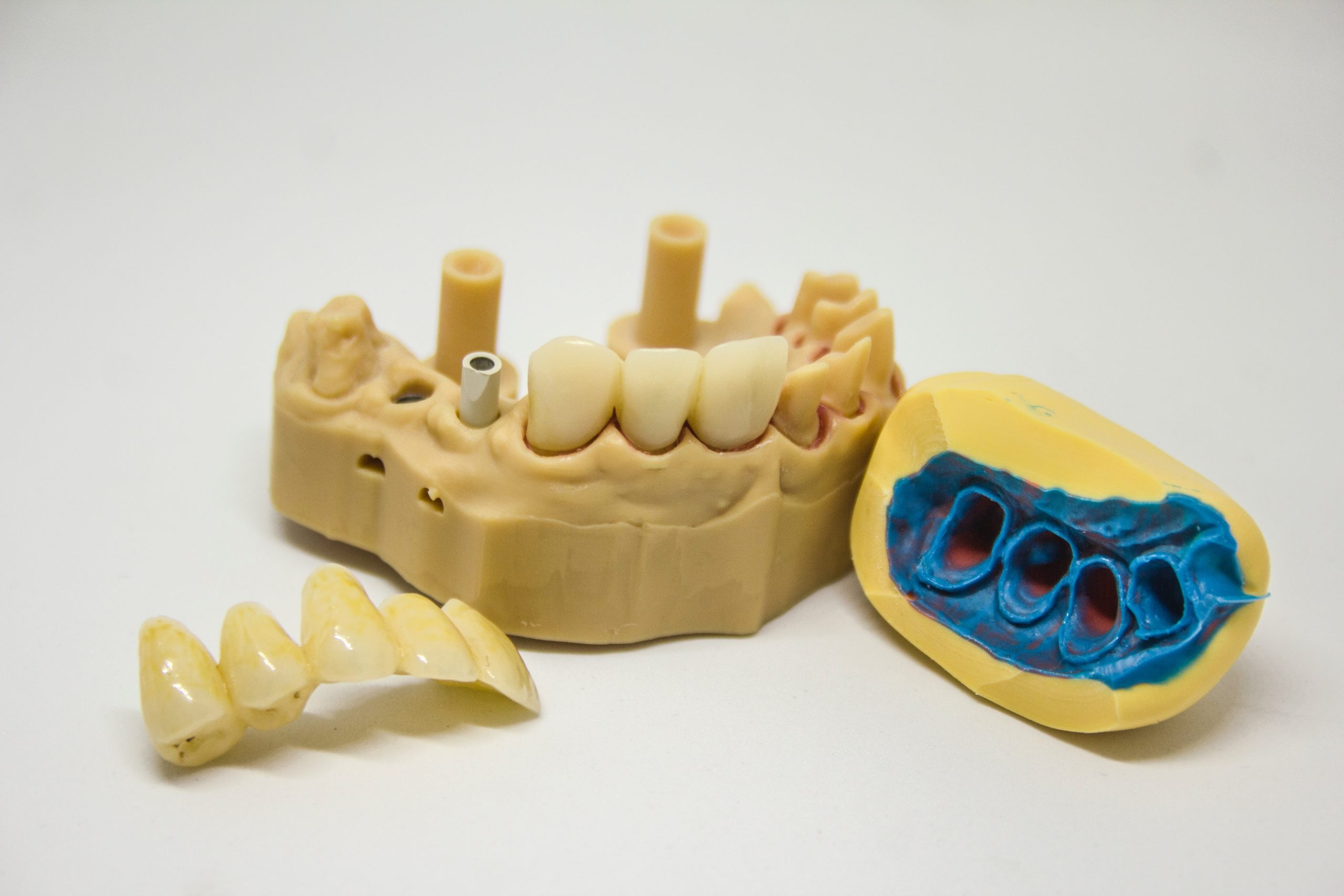 Current Status of Digital Complete Dentures Technology