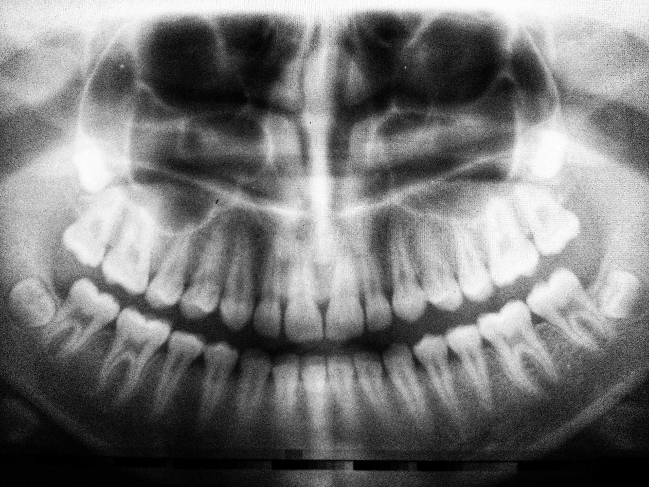 Radiation in dental practice: awareness, protection and recommendations