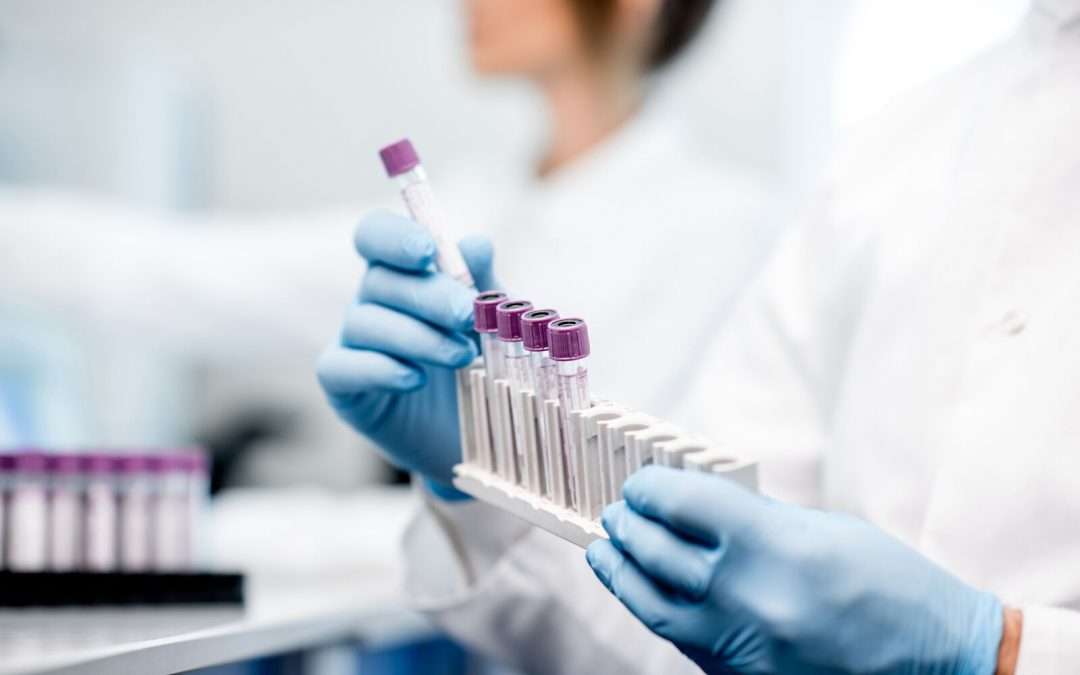 Vatiquinone Shows Additional Benefits in Friedreich Ataxia Despite Failing to Meet Primary End Point