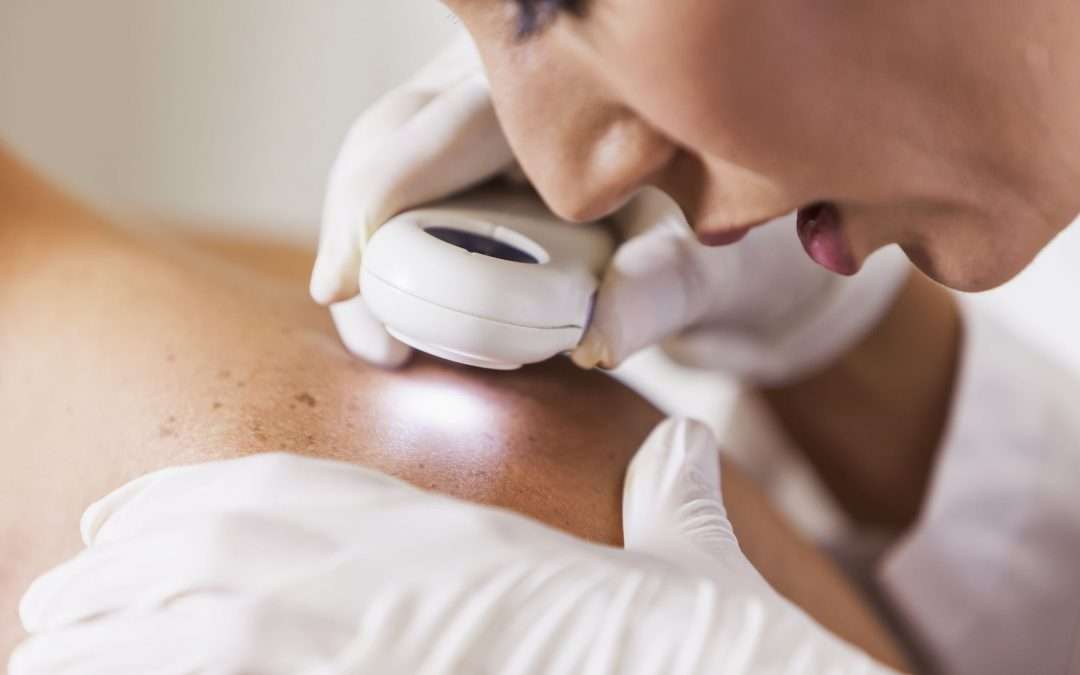 American Academy of Dermatology Launches Innovative Project to Improve Outcomes for Patients with Life-Threatening Pustular Psoriasis