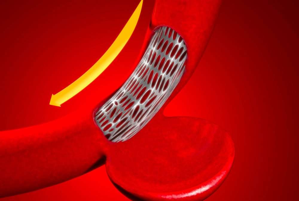 Aortic Dissection: A Challenging Diagnosis with Diverse Symptoms and Fatal Consequences